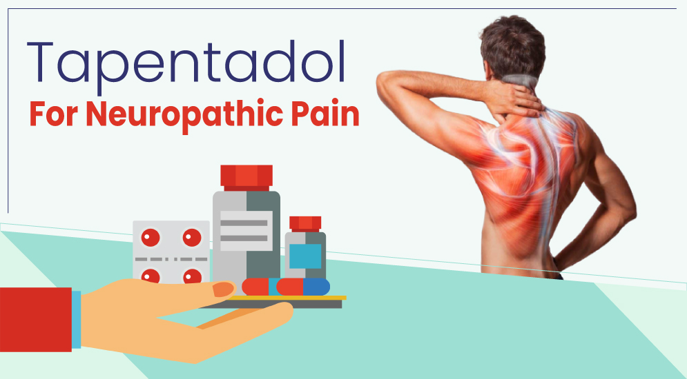 Use Tapentadol 100 mg Tablet to Find Quick Relief from Body Pain